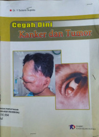 Image of Cegah DIni Kanker dan Tumor